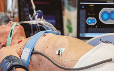 電阻抗斷層掃描系統