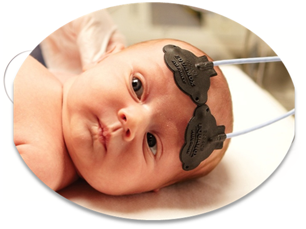 腦部/組織血氧飽和測定儀