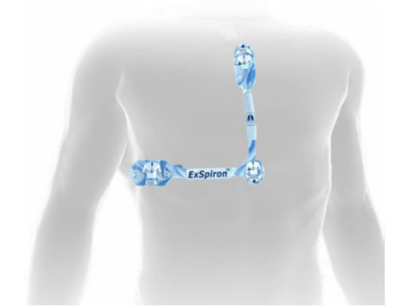 呼吸容積監測儀