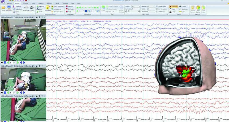 腦波分析軟體組