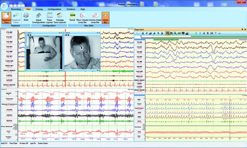 多項睡眠分析軟體組